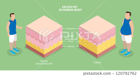 3D Isometric Flat Vector Illustration of Human Body Excess Fat, Obesity 3D Isometric Flat Vector Illustration of Human Body Excess Fat, Obesity 120792762