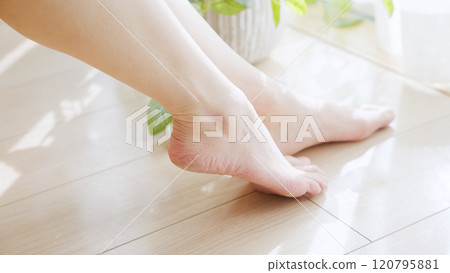 Women who are concerned about dry heels and calluses 120795881