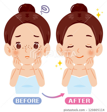 一個有雀斑和斑點的女人前後的插圖 一個有雀斑和斑點的女人前後的插圖 120805114