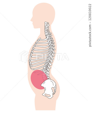 Rib gap, arched back, correct posture and arched back posture Rib gap, arched back, correct posture and arched back posture 120810022