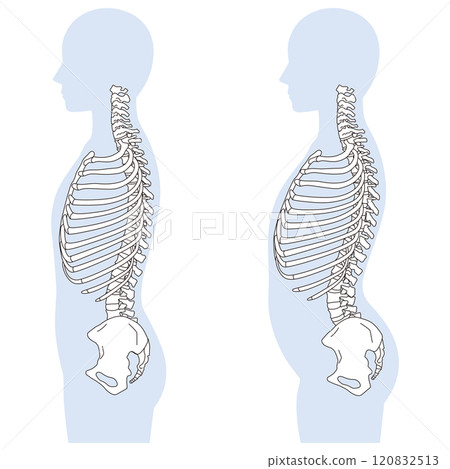 Rib gap, arched back, correct posture and arched back posture 120832513