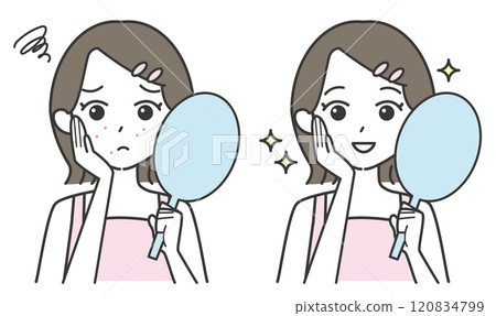 痘痘和皮膚粗糙都有改善的女孩 120834799