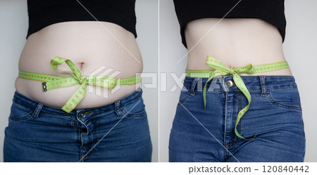 Woman before and after weight loss, weight loss. Abdominoplasty or diet aftereffect. Belly tied with measuring tape in the form of a bow 120840442
