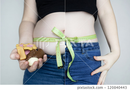 Woman before and after weight loss, weight loss. Abdominoplasty or diet aftereffect. Belly tied with measuring tape in the form of a bow 120840443