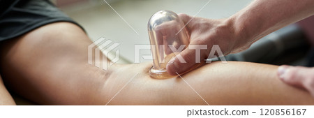 Applying Cupping Therapy on Arm for Muscle Recovery 120856167