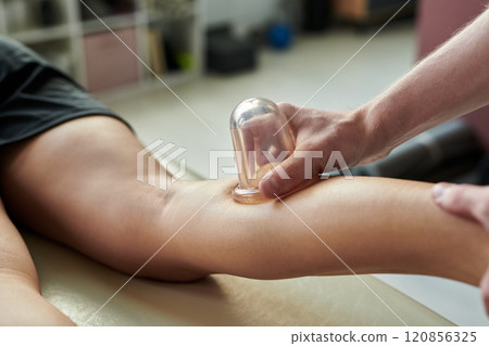 Applying Cupping Therapy on Person's Arm 120856325