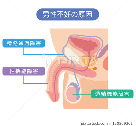 男性不孕症的原因 不孕症 生殖醫學 120869301