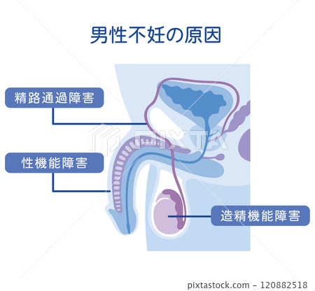 Causes of male infertility Infertility Reproductive medicine Causes of male infertility Infertility Reproductive medicine 120882518