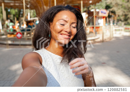 Happy woman with vitiligo skin problem taking Happy woman with vitiligo skin problem taking 120882581