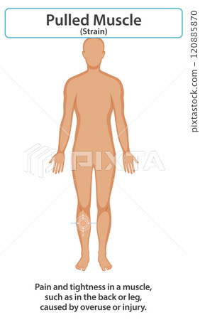 Understanding Muscle Strain and Recovery 120885870