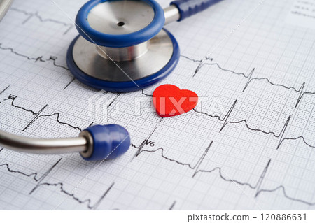Stethoscope on electrocardiogram (ECG), heart wave, heart attack, cardiogram report. 120886631