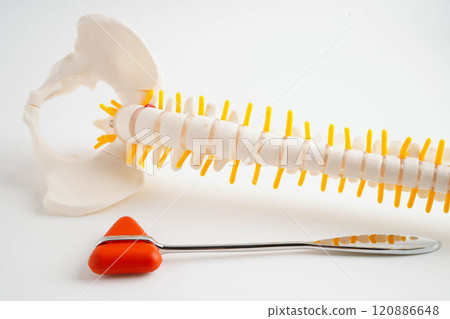 Spinal nerve and bone with knee reflex hammer, Lumbar spine displaced herniated disc fragment, Model for treatment medical in the orthopedic department. 120886648