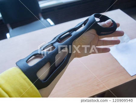 Hand splint corset prosthesis printed on 3D printer from molten black plastic powder on hand. Medical orthosis fixator plastic overlay created on 3D printer. New modern medical 3D printing technology, 120909540