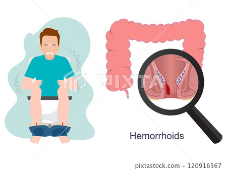 Man sitting on toilet feeling pain. 120916567