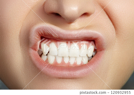 Dental Beauty. Beautiful Macro with perfect White Teeth. Whitening Tooth, Oral Hygiene, Wellness Treatment Dental Beauty. Beautiful Macro with perfect White Teeth. Whitening Tooth, Oral Hygiene, Wellness Treatment 120932955