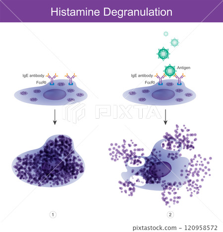 Histamine Degranulation. Histamine degranulation out of mast cell. 120958572