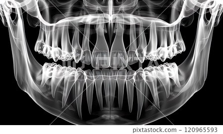 牙科 X 光影像的插圖 120965593