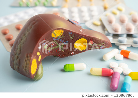 Liver model with pill drug treatment, Cirrhosis, Liver cancer, fatty liver. 120967903