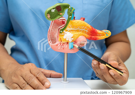 Pancreatitis, pancreatic cancer, Asian doctor with pancreas, gallbladder and bile duct human anatomy model at hospital. 120967909