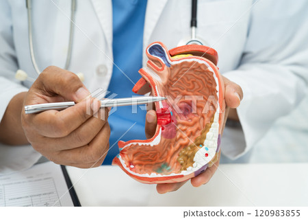 Stomach disease, doctor with human anatomy model for study diagnosis and treatment in hospital. Stomach disease, doctor with human anatomy model for study diagnosis and treatment in hospital. 120983855