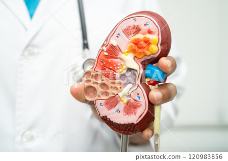 Cardiovascular disease CVD, Asian doctor holding human anatomy model for learn and treat heart disease. 120983856