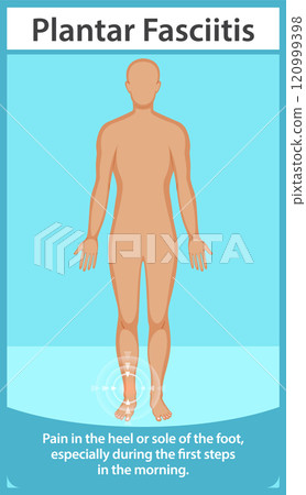 Understanding Plantar Fasciitis Pain 120999398