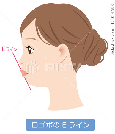 Side profile of E-line with protruding mouth Side profile of E-line with protruding mouth 121001598