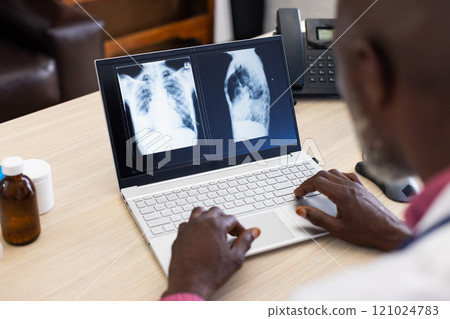 African american male doctor using laptop with radiograph on screen at doctor office African american male doctor using laptop with radiograph on screen at doctor office 121024783