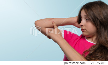 Girl pointing to scrape on arm 121025308