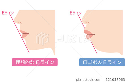 Ideal E-line and protruding E-line profile Ideal E-line and protruding E-line profile 121038963