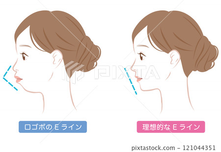 Ideal E-line and protruding E-line profile Ideal E-line and protruding E-line profile 121044351