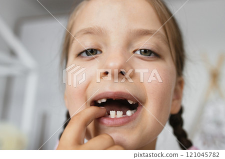 Close-up portrait of young Caucasian girl showing missing baby teeth, smiling proudly. She is at home, displaying natural tooth gaps, symbolizing childhood milestones. 121045782