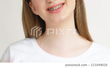 Healthy teeth. Dental care. Oral hygiene. Closeup of contented teen girl charming smile with metal braces isolated on white background. 121049020