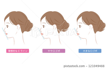 Ideal E-line and protruding E-line profile Ideal E-line and protruding E-line profile 121049488