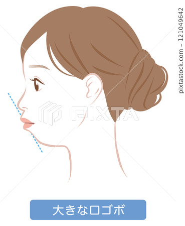 Large protruding mouth with an E-line profile 121049642