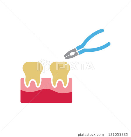 Dental pliers removing a cracked tooth from gum tissue 121055885