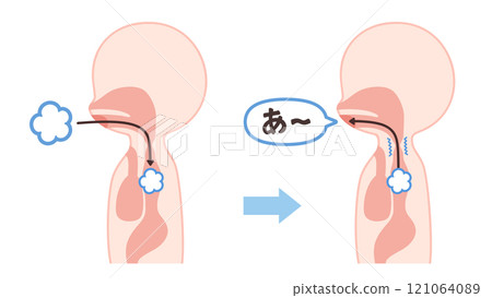 Illustration of the method of esophageal speech 121064089