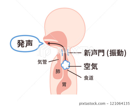 Illustration of the mechanism of esophageal speech 121064135