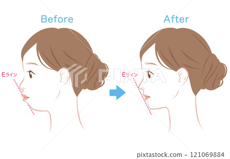 Ideal E-line and protruding E-line profile Ideal E-line and protruding E-line profile 121069884