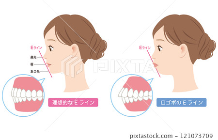 Ideal E-line and protruding E-line profile Ideal E-line and protruding E-line profile 121073709