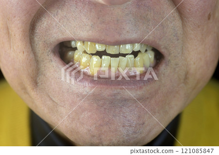 Close up of healthy old man teeth Close up of healthy old man teeth 121085847