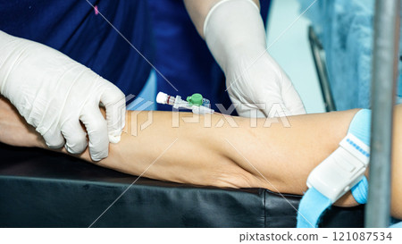 A catheter or IV needle in a patient's hand. 121087534