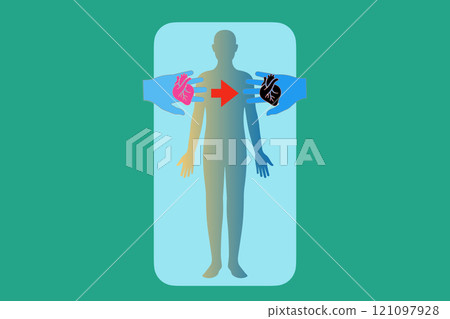 Organ transplantation 121097928