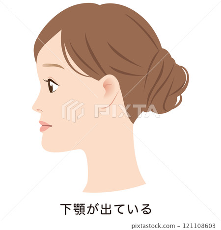 下顎前突的輪廓，下牙突出的 E 線 121108603