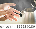 Close up of hands,woman dropped a kettle of boiling water and scalded her hand,burning pain,physical injury,scald the skin with boiling liquid,hot steam in electric kettle,hot water danger,accident 121130189