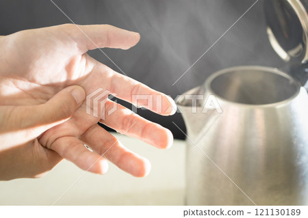 Close up of hands,woman dropped a kettle of boiling water and scalded her hand,burning pain,physical injury,scald the skin with boiling liquid,hot steam in electric kettle,hot water danger,accident 121130189
