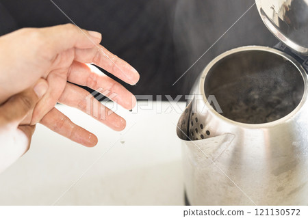 Hands with burning pain from scalding heat water,boiling water and hot steam in the electric kettle spilled onto skin of her hand,girl suffering harm and injury,scald blister,accident at home 121130572