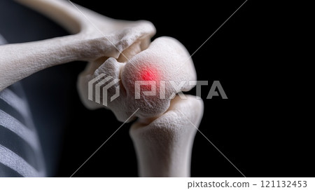 Shoulder agony: visualization of pain in joint, featuring red glowing area that highlights source of discomfort, representing inflammation or injury, its effect on daily activities and mobility. Shoulder agony: visualization of pain in joint, featuring red glowing area that highlights source of discomfort, representing inflammation or injury, its effect on daily activities and mobility. 121132453