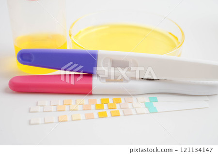 Urinalysis, urine cup with reagent strip pH paper test and comparison chart in laboratory. Urinalysis, urine cup with reagent strip pH paper test and comparison chart in laboratory. 121134147