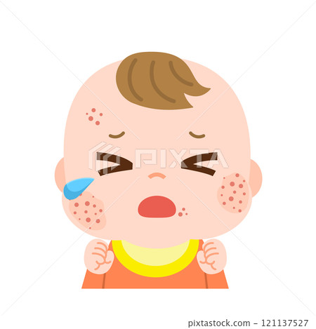 Illustration of a crying baby with a rash on his face 121137527